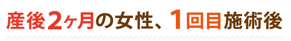 産後2ヶ月の女性、1回目施術後